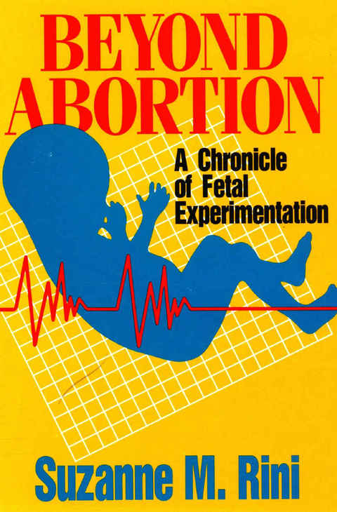 Cover image for book Beyond Abortion