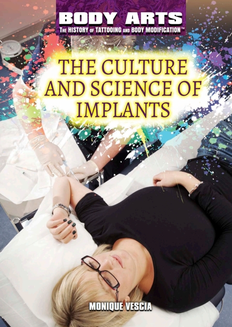 Cover image for book The Culture and Science of Implants
