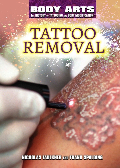 Cover image for book Tattoo Removal