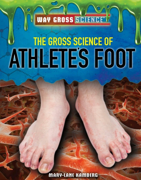 Cover image for book The Gross Science of Athlete’s Foot