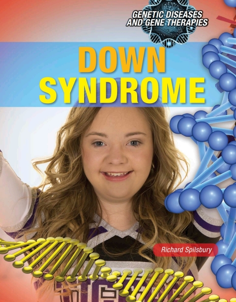Cover image for book Down Syndrome