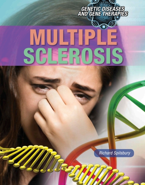 Cover image for book Multiple Sclerosis