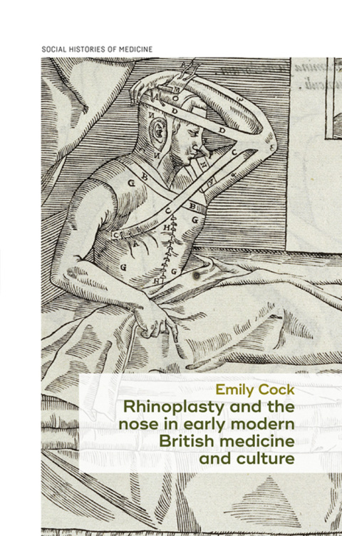 Cover image for book Rhinoplasty and the nose in early modern British medicine and culture