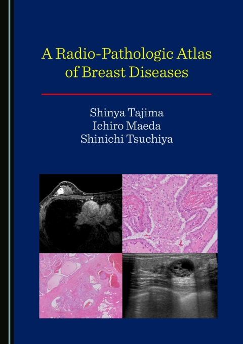 Cover image for book A Radio-Pathologic Atlas of Breast Diseases