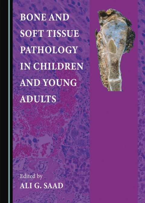 Cover image for book Bone and Soft Tissue Pathology in Children and Young Adults