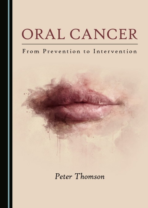 Cover image for book Oral Cancer
