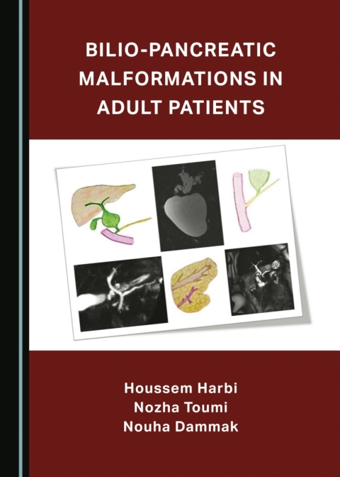 Cover image for book Bilio-Pancreatic Malformations in Adult Patients