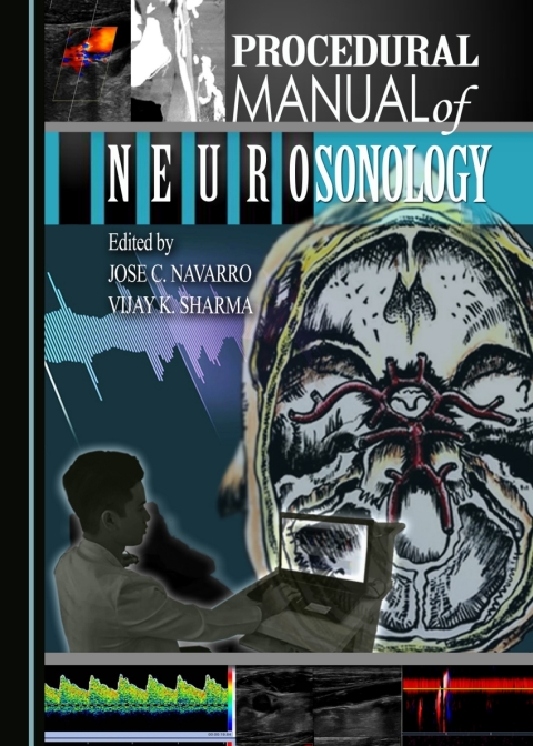 Cover image for book Procedural Manual of Neurosonology