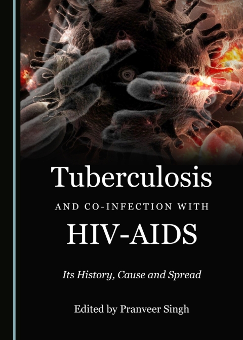 Cover image for book Tuberculosis and Co-infection with HIV-AIDS
