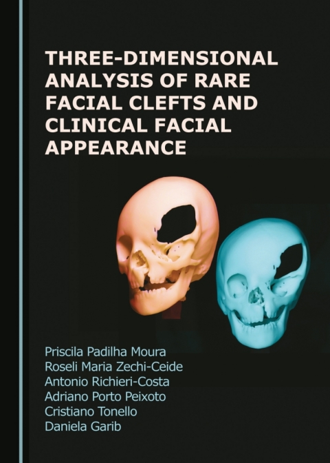 Cover image for book Three-Dimensional Analysis of Rare Facial Clefts and Clinical Facial Appearance