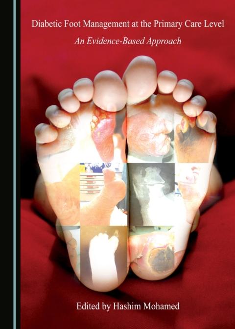 Cover image for book Diabetic Foot Management at the Primary Care Level
