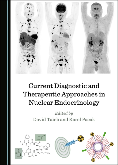 Cover image for book Current Diagnostic and Therapeutic Approaches in Nuclear Endocrinology