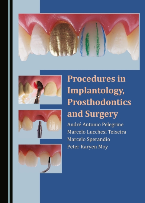 Cover image for book Procedures in Implantology, Prosthodontics and Surgery