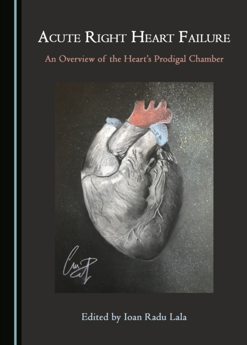 Cover image for book Acute Right Heart Failure