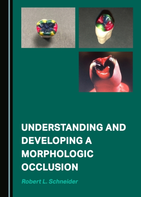 Cover image for book Understanding and Developing a Morphologic Occlusion
