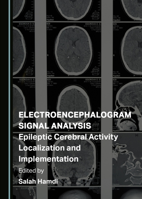 Cover image for book Electroencephalogram Signal Analysis