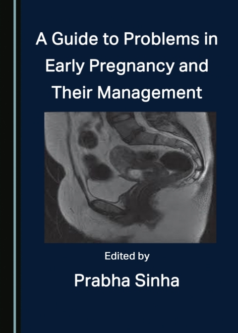 Cover image for book A Guide to Problems in Early Pregnancy and Their Management