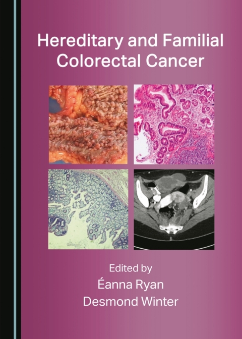 Cover image for book Hereditary and Familial Colorectal Cancer