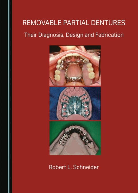 Cover image for book Removable Partial Dentures