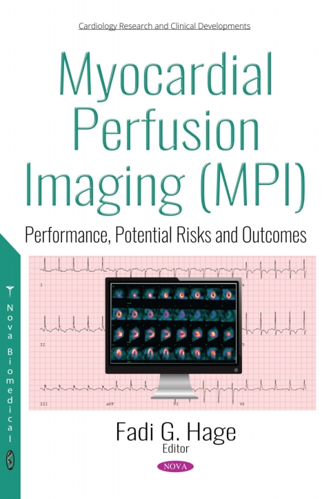 Cover image for book Myocardial Perfusion Imaging (MPI): Performance, Potential Risks and Outcomes
