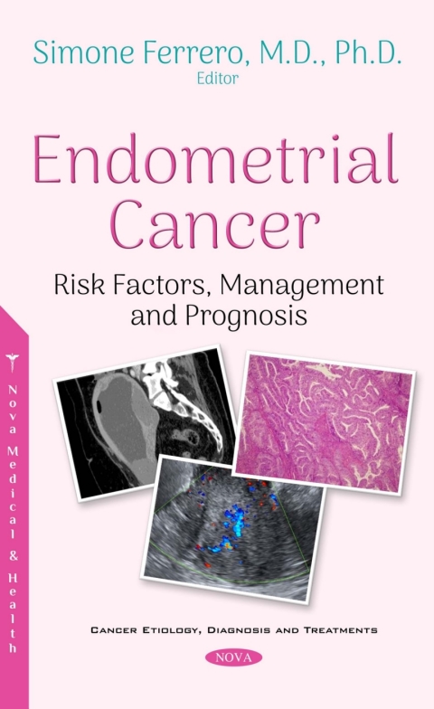 Cover image for book Endometrial Cancer: Risk Factors, Management and Prognosis