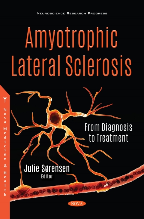 Cover image for book Amyotrophic Lateral Sclerosis: From Diagnosis to Treatment