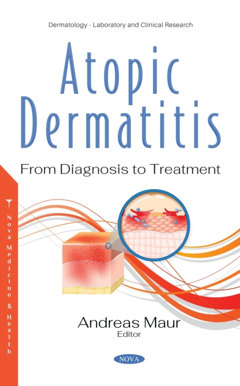 Cover image for book Atopic Dermatitis: From Diagnosis to Treatment