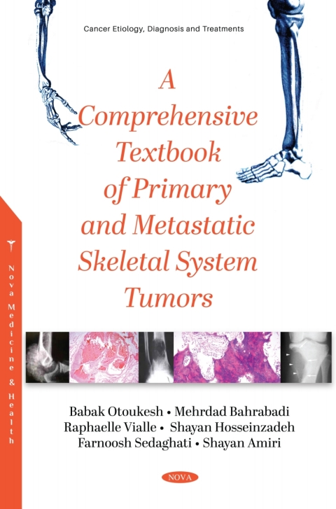 Cover image for book A Comprehensive Textbook of Primary and Metastatic Tumors of the Skeletal System