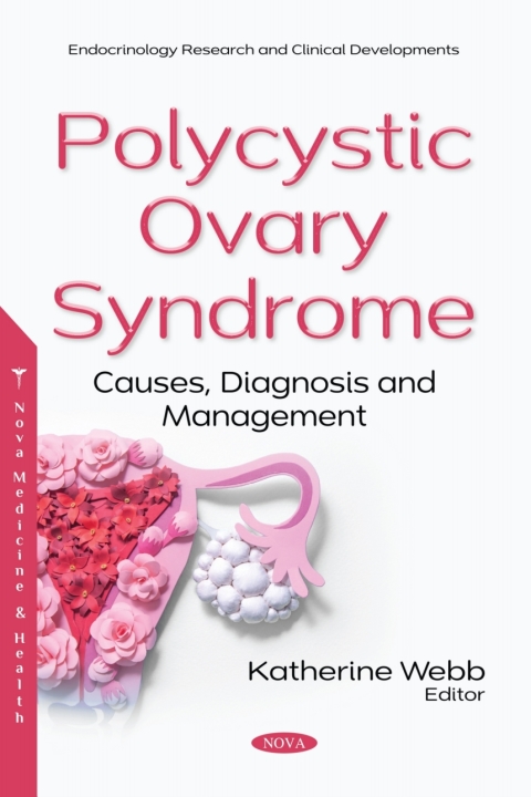 Cover image for book Polycystic Ovary Syndrome: Causes, Diagnosis and Management
