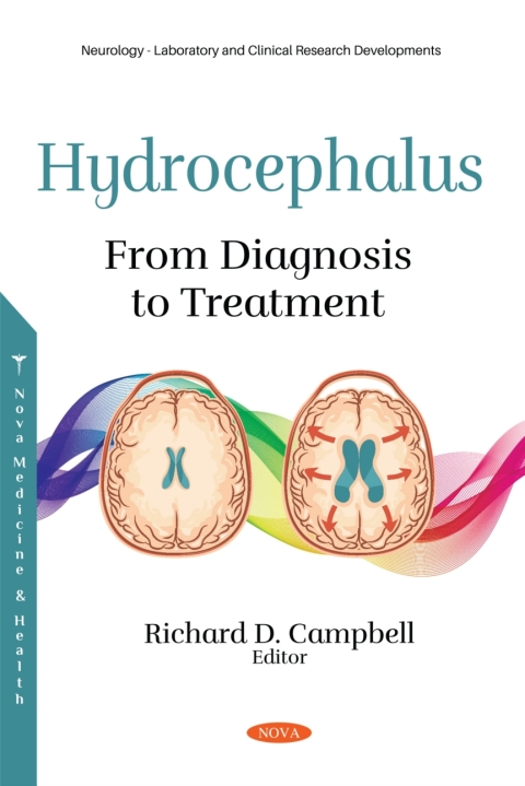 Cover image for book Hydrocephalus: From Diagnosis to Treatment