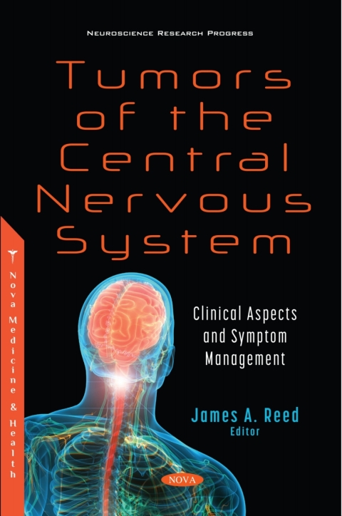 Cover image for book Tumors of the Central Nervous System: Clinical Aspects and Symptom Management