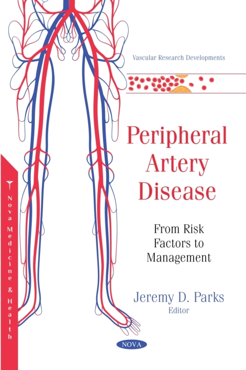 Cover image for book Peripheral Artery Disease: From Risk Factors to Management