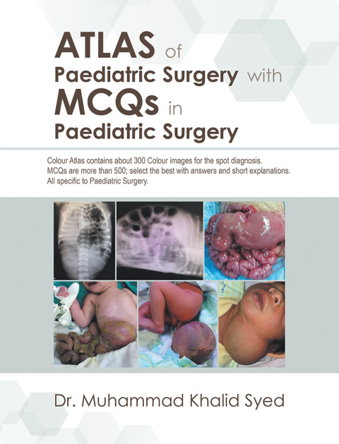 Cover image for book Atlas of Paediatric Surgery with Mcqs in Paediatric Surgery