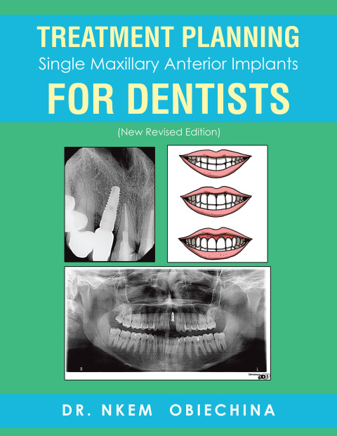 Cover image for book Treatment Planning Single Maxillary Anterior Implants for Dentists