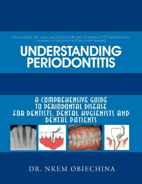 Cover image for book Understanding Periodontitis