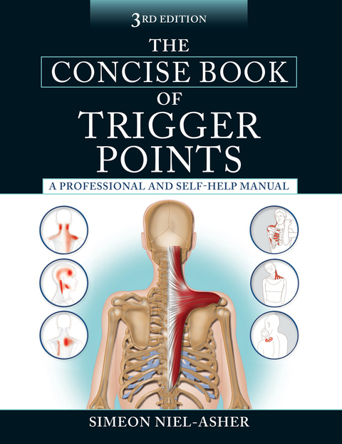Cover image for book The Concise Book of Trigger Points, Third Edition