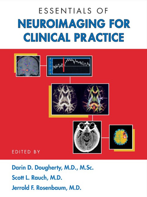 Cover image for book Essentials of Neuroimaging for Clinical Practice