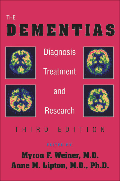 Cover image for book The Dementias