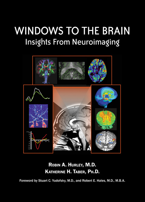Cover image for book Windows to the Brain