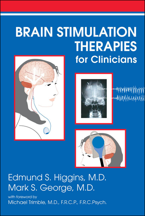 Cover image for book Brain Stimulation Therapies for Clinicians