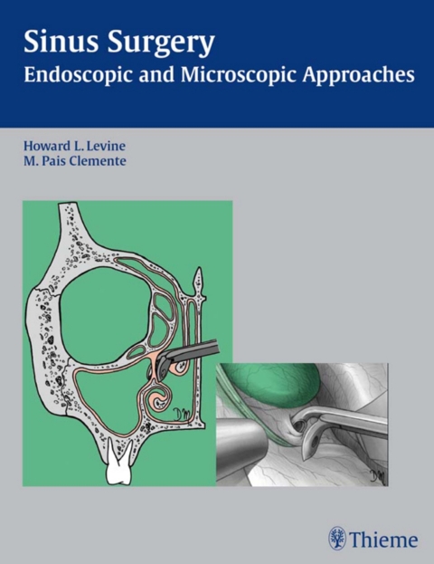 Cover image for book Sinus Surgery