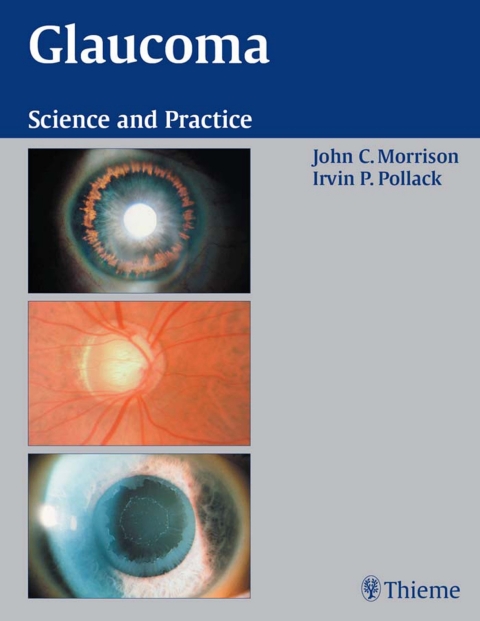 Cover image for book Glaucoma