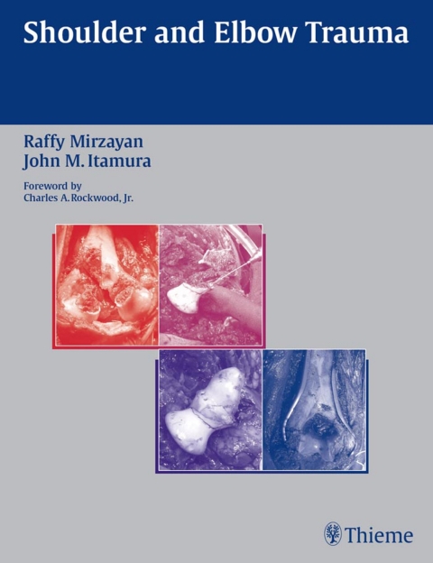 Cover image for book Shoulder and Elbow Trauma