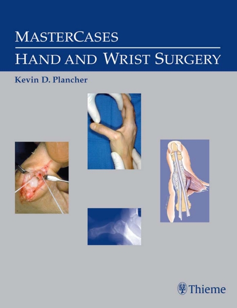MasterCases in Hand and Wrist Surgery 