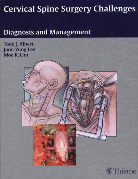 Cover image for book Cervical Spine Surgery Challenges: Diagnosis and Management