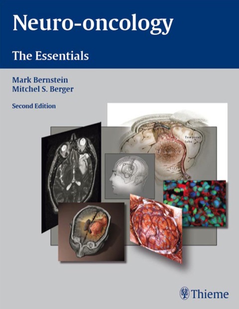 Cover image for book Neuro-Oncology: The Essentials