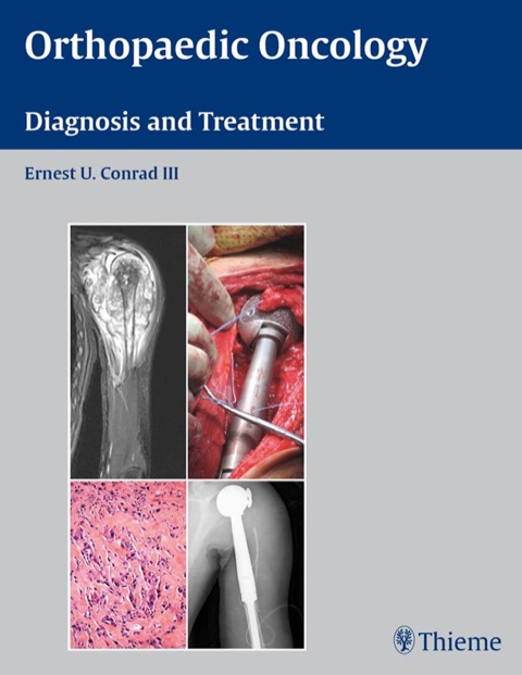 Cover image for book Orthopaedic Oncology
