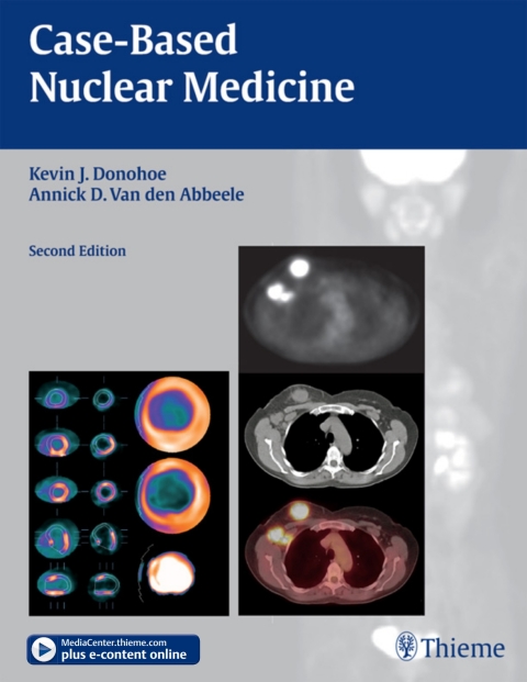 Cover image for book Case-Based Nuclear Medicine
