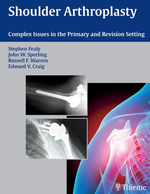 Cover image for book Shoulder Arthroplasty