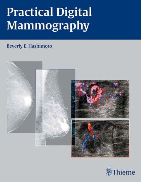 Cover image for book Practical Digital Mammography